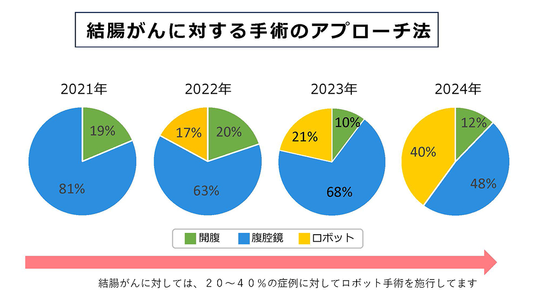 直腸がんに対する手術のアプローチ法